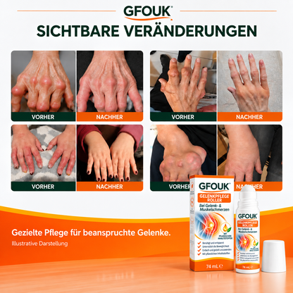 GFOUK® 0,05 MM Mikro-Nadel-Roller zur Unterstützung der Knochen- und Gelenkregeneration (0.05MM)
