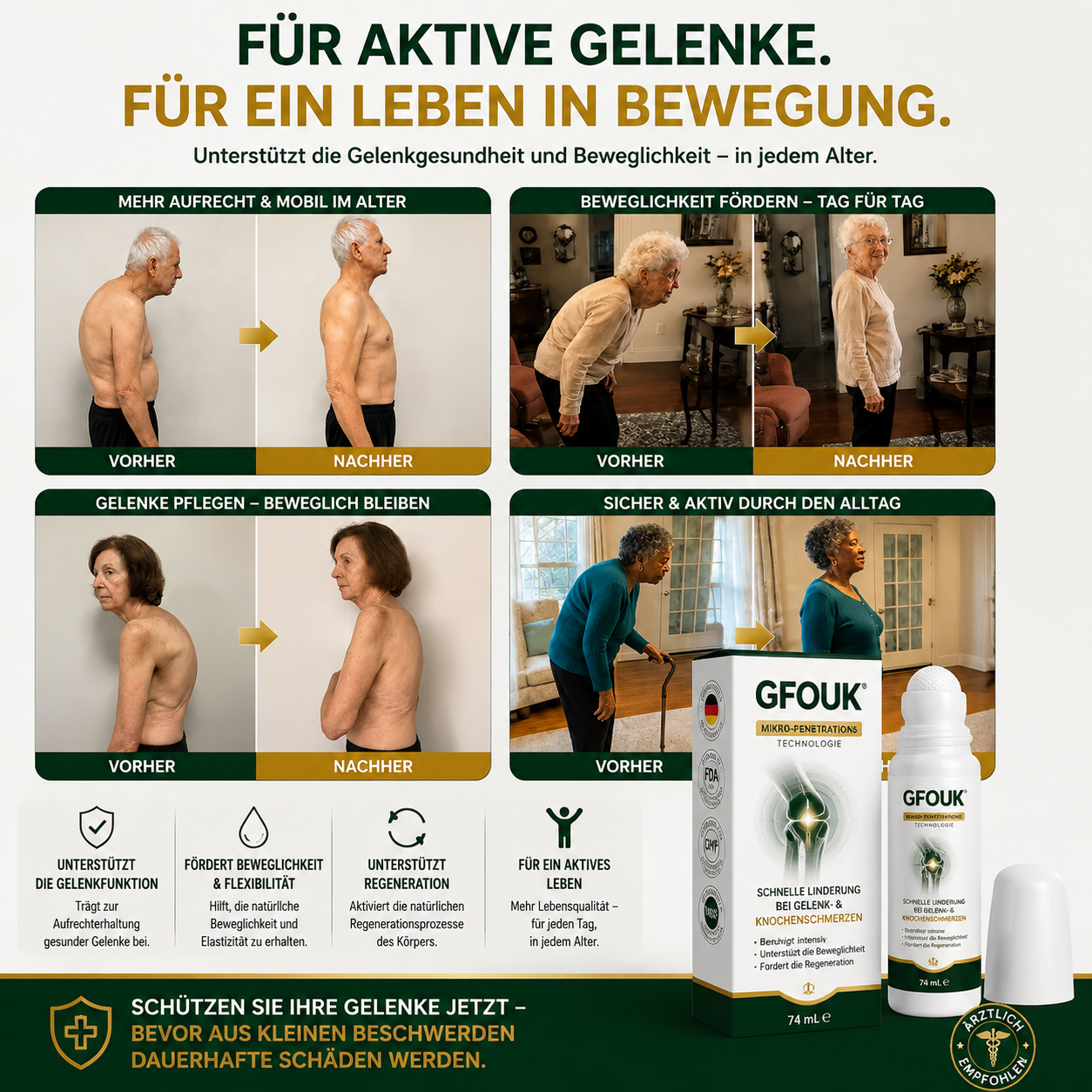 GFOUK® 0,05 mm Mikro-Nadel-Roller zur Unterstützung der Knochen- und Gelenkregeneration