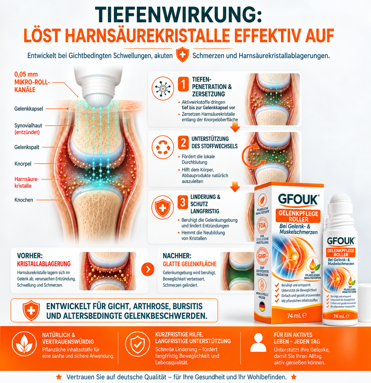 GFOUK® 0,05 MM Mikro-Nadel-Roller zur Unterstützung der Knochen- und Gelenkregeneration (0.05MM)