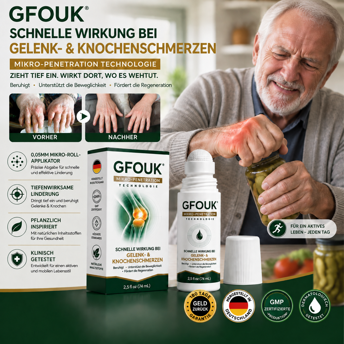 GFOUK® （0.05 mm） Mikro-Nadel-Roller zur Unterstützung der Knochen- und Gelenkregeneration