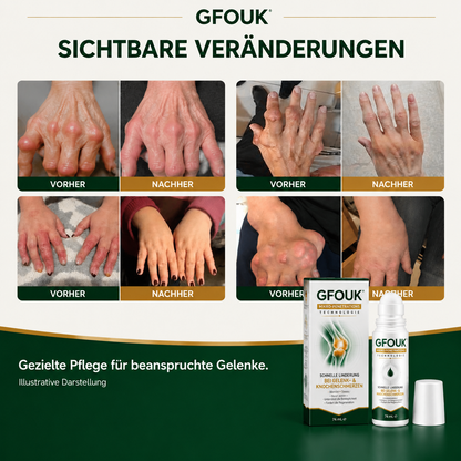 GFOUK® （0.05 mm） Mikro-Nadel-Roller zur Unterstützung der Knochen- und Gelenkregeneration